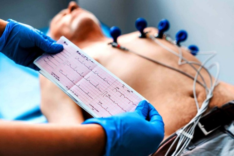 Elettrocardiogramma ECG